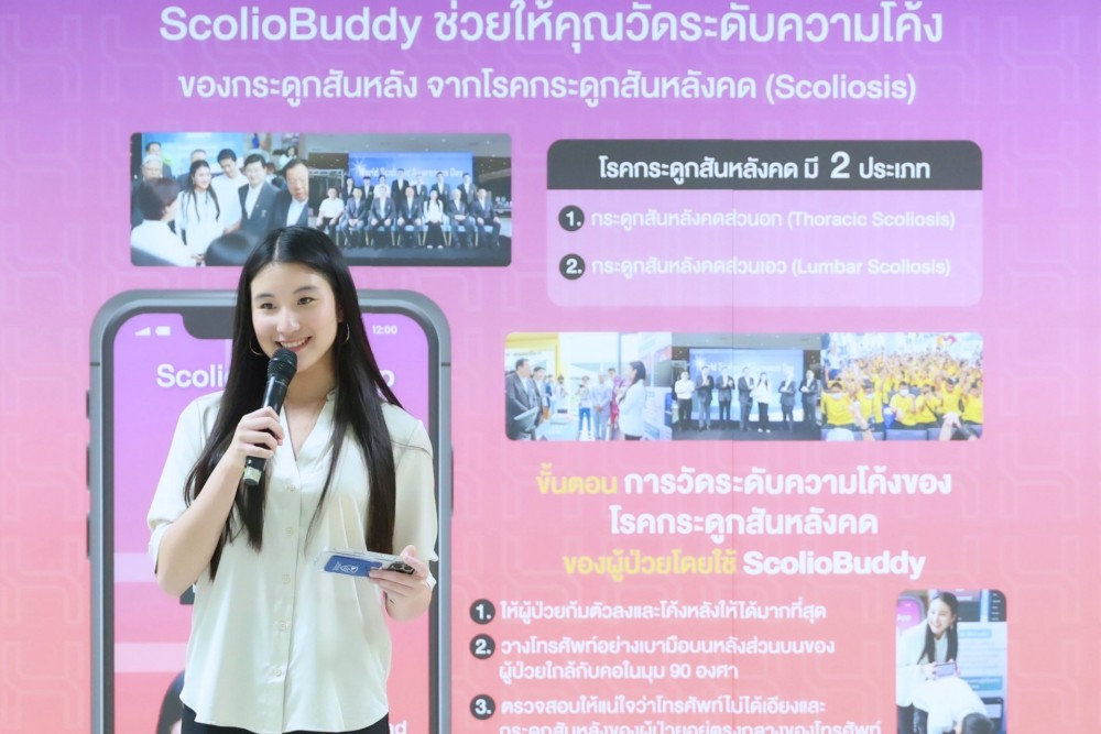 ScolioBuddy ตรวจคัดกรองโรคกระดูกสันหลังคด ปรากฏการณ์ใหม่วงการแพทย์ไทย